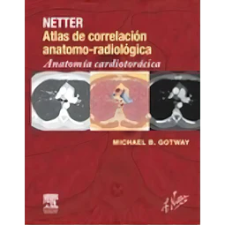 Netter Atlas de Correlación Anatomo-Radiológica