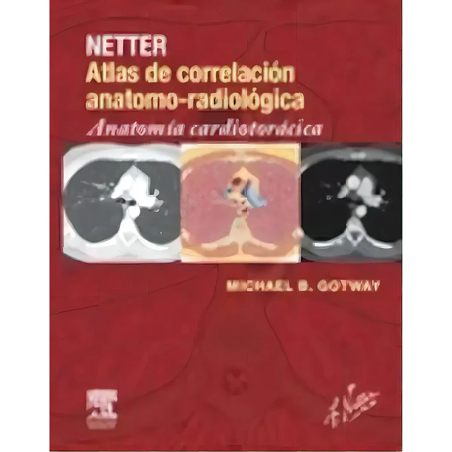 Netter Atlas de Correlación Anatomo-Radiológica