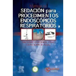 Manual de sedación para procedimientos endoscópicos respiratorios