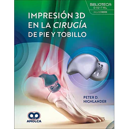 Impresión 3D en la cirugía de pie y tobillo