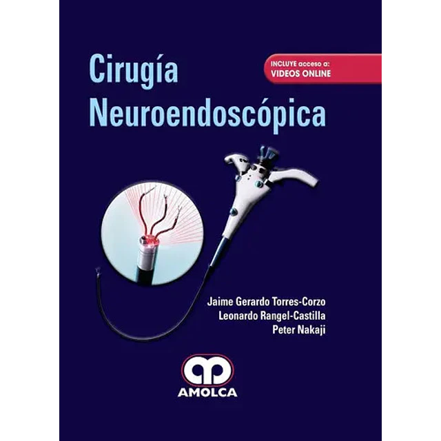 Cirugía Neuroendoscópica
