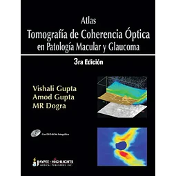 Atlas Tomografía de Coherencia Óptica en Aptología Macular y Glaucoma