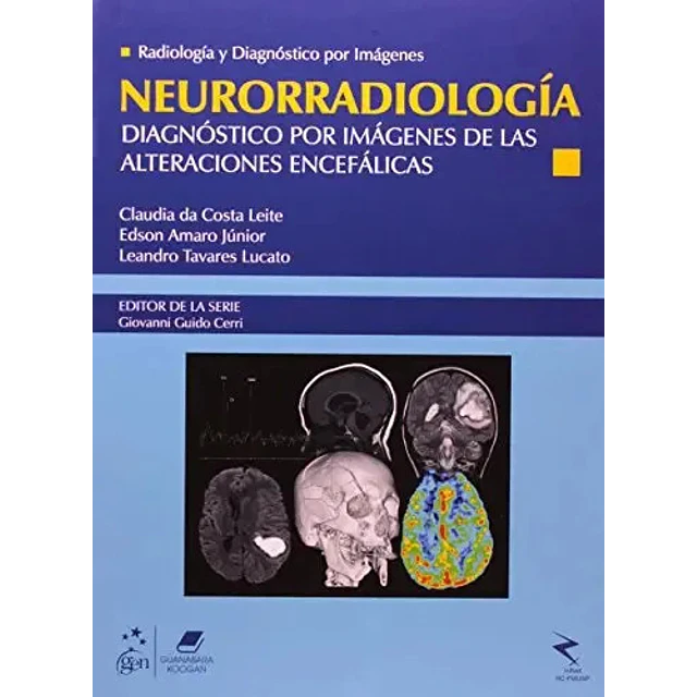 Neurorradiología. Radiología y diagnóstico por imágenes