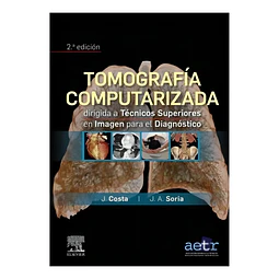 Tomografía computarizada