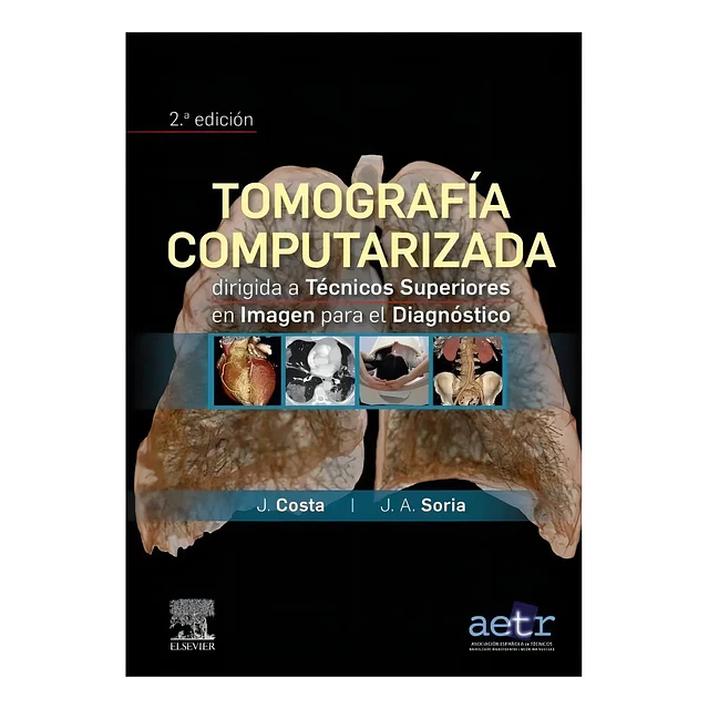 Tomografía computarizada