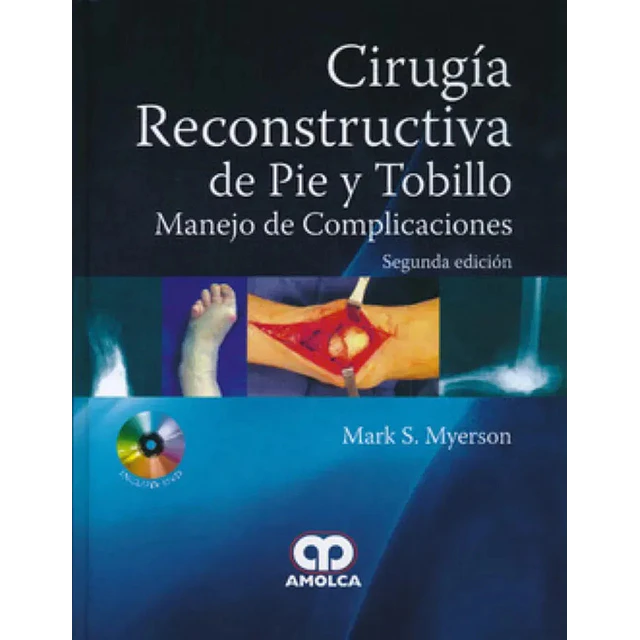 Cirugía Reconstructiva de Pie y Tobillo
