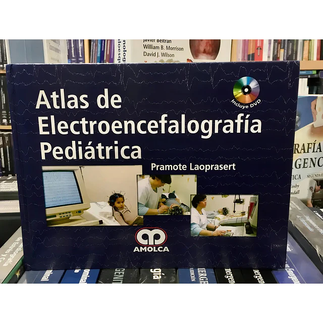 Atlas de Electroencefalografía Pediátrica