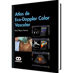 Atlas de Eco-Doppler Color Vascular