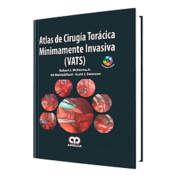 Atlas de Cirugía Torácica Mínimamente Invasiva (VATS)