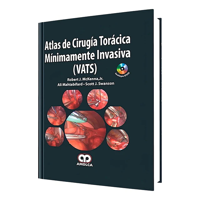Atlas de Cirugía Torácica Mínimamente Invasiva (VATS)