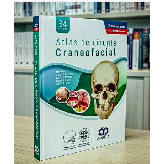 Atlas de cirugía craneofacial