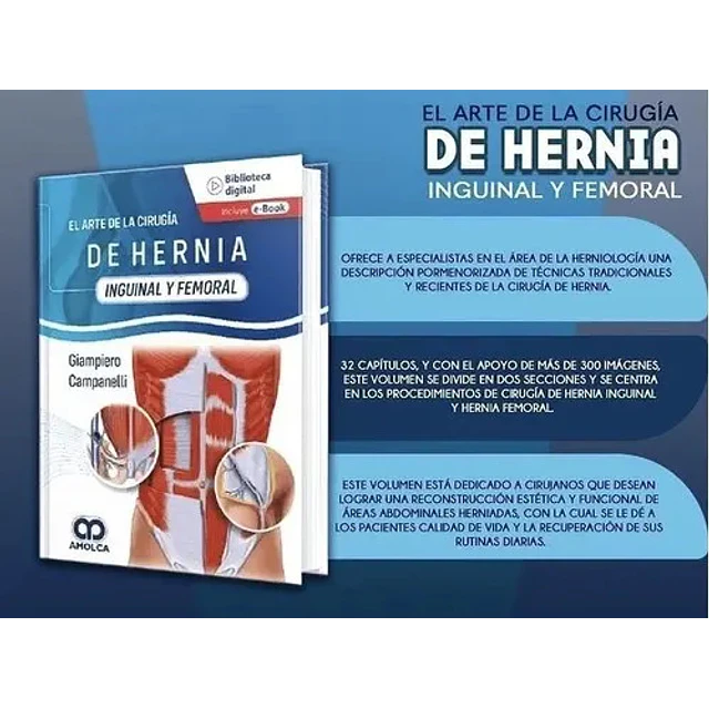 El Arte de la Cirugía de la Hernia - Inguinal y Femoral
