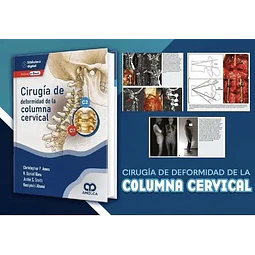 Cirugía de deformidad de la Columna Cervical