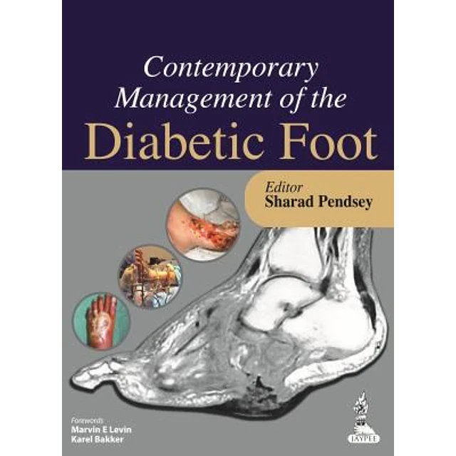 Contemporary Management of the Diabetic Foot