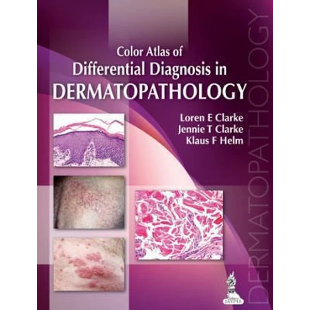 Color Atlas of Differential Diagnosis in Dermatopathology