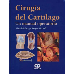Cirugía de Cartílago