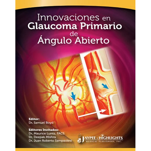 Innovaciones en Galucoma Primario de Ángulo Abierto