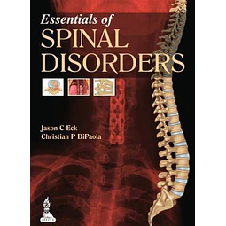 Essentials of spinal Disorders