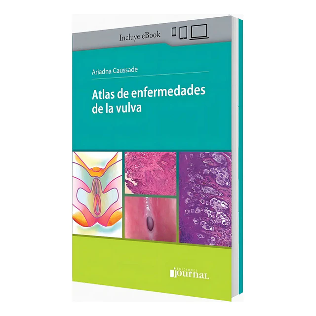 Atlas de enfermedades de la vulva