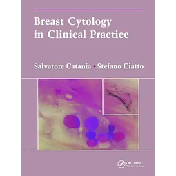 Breast Cytology in clinical practice