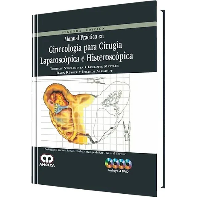 Manual Práctico en Ginecología para Cirugía Laparoscópica e Histeroscópica
