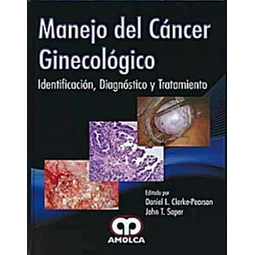 Manejo del Cáncer Ginecológico