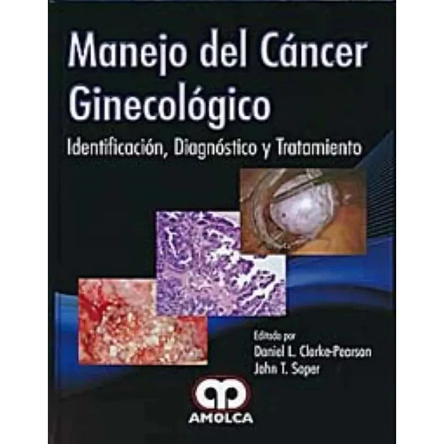Manejo del Cáncer Ginecológico