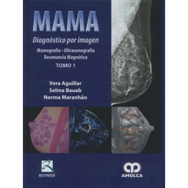 Mama Diagnóstico por imagen 2 Tomos Mamografía-Ultrasonografía-Resonancia Magnética