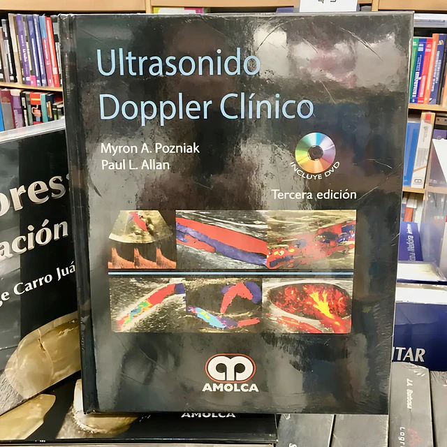 Ultrasonido doppler clínico