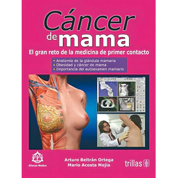 Cáncer de Mama