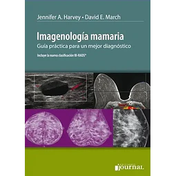 Imagenología mamaria