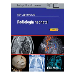 Radiología Neonatal