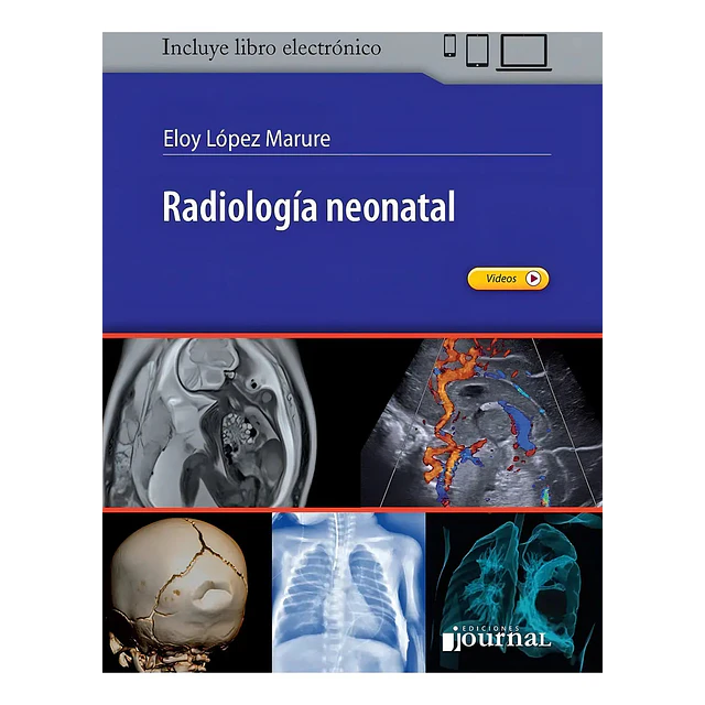 Radiología Neonatal
