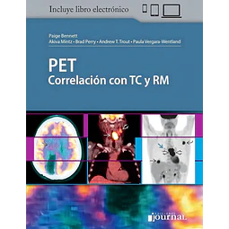 PET Correlación con TC y RM
