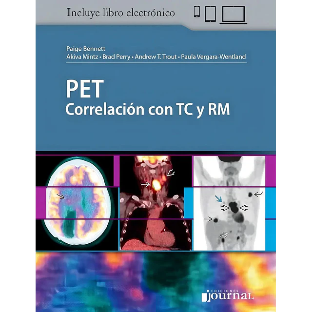 PET Correlación con TC y RM