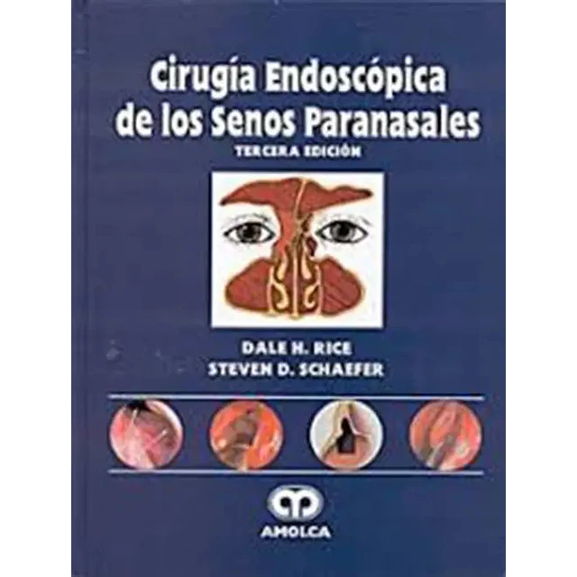 Cirugía Endoscópica de los Senos Paranasales