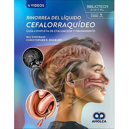 Rinorrea del líquido cefalorraquídeo. Guía completa de evaluación y tratamiento
