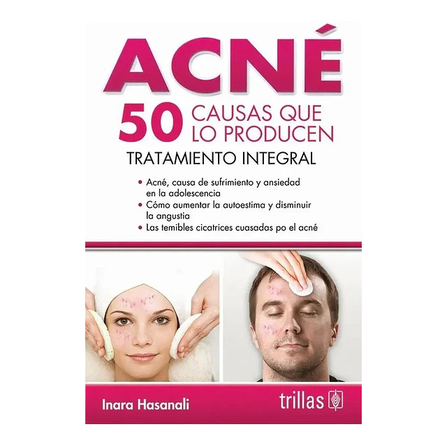 Acné 50 causas que lo producen