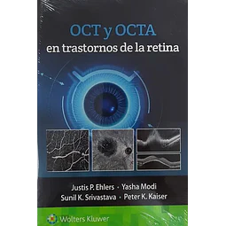 OCT y OCTA en trastornos de la retina