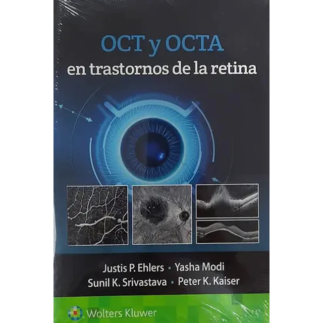 OCT y OCTA en trastornos de la retina
