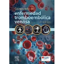 Compendio de enfermedad tromboembólica venosa