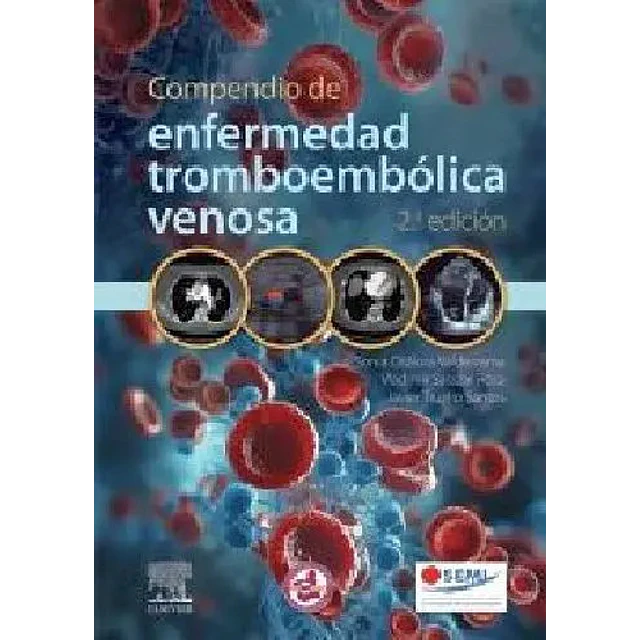 Compendio de enfermedad tromboembólica venosa