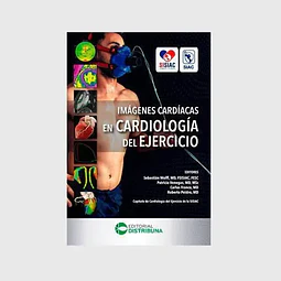 Imágenes cardiacas en cardiología del ejercicio