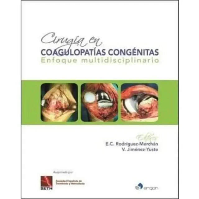 Cirugía en Coagulopatías Congénitas