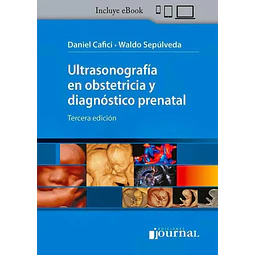 Ultrasonografía en Obstetricia y Diagnóstico Prenatal (HandBook) Ed.3