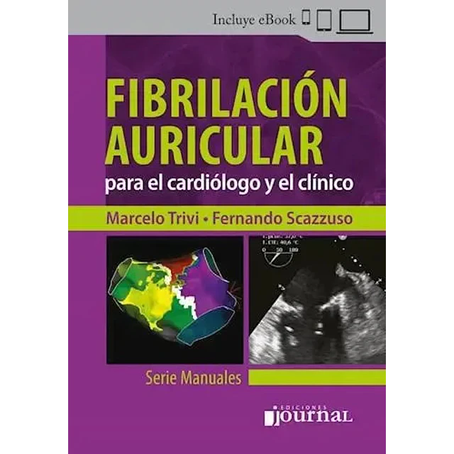 Fibrilación Auricular
