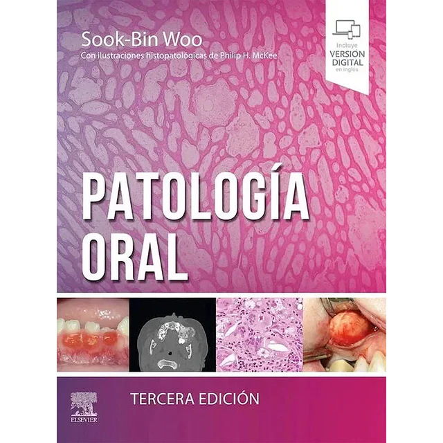 Patología oral