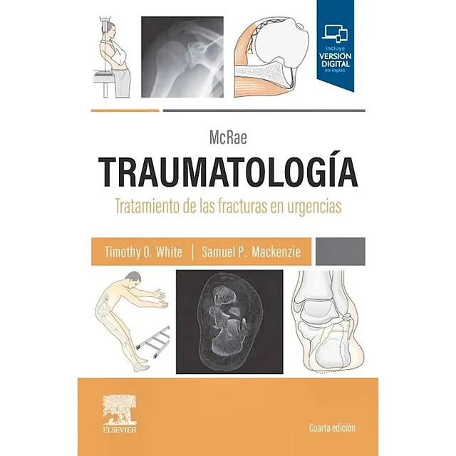 MC RAE Traumatología. Tratamiento de las fracturas