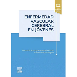 Enfermedad vascular cerebral en jóvenes