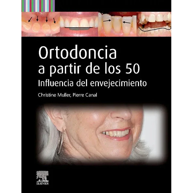 Ortodoncia a partir de los 50. Influencia del envejecimiento